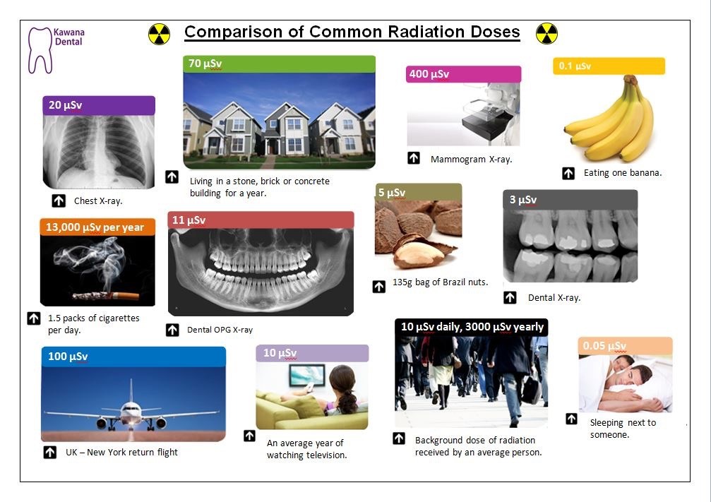 dental radiation exposure comparison chart